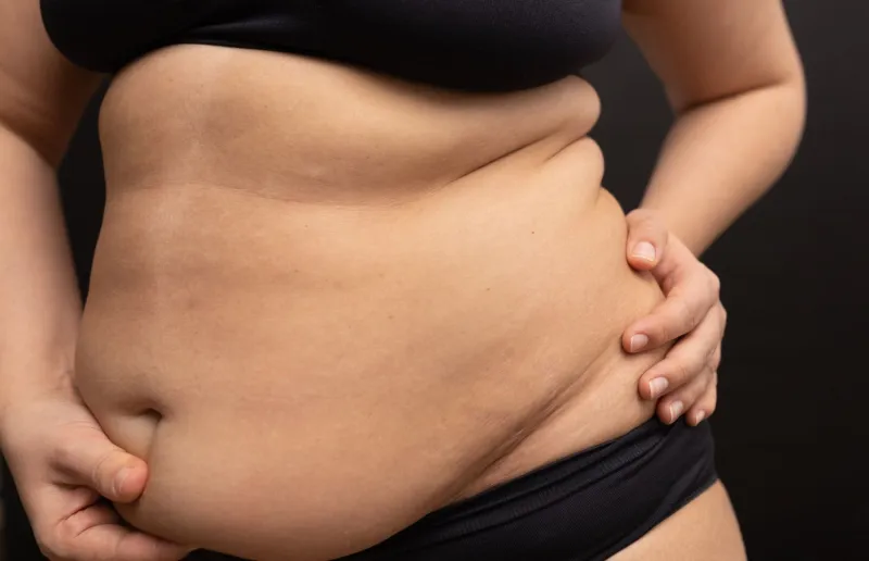 Dopo i 40 anni, gli estrogeni calano e il corpo riceve un solo segnale: trattieni le riserve.