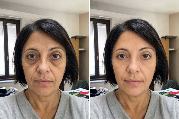 Eslow Age
